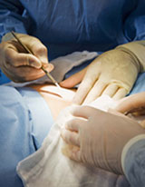 Natural Remedies after Cancer Surgery